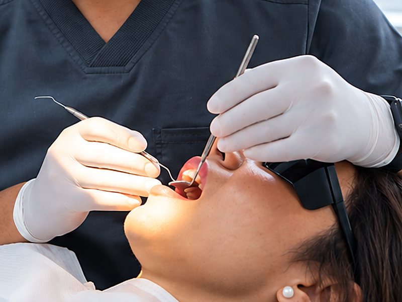 Tratamiento de estética dental en Lake Dental